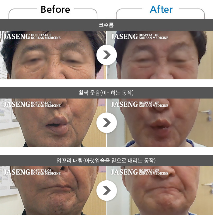 ڻѹ溴 ġ ȸŰ渶 ġ- 4  ȸ鸶 ߻Ͽ ġ  Կġ 