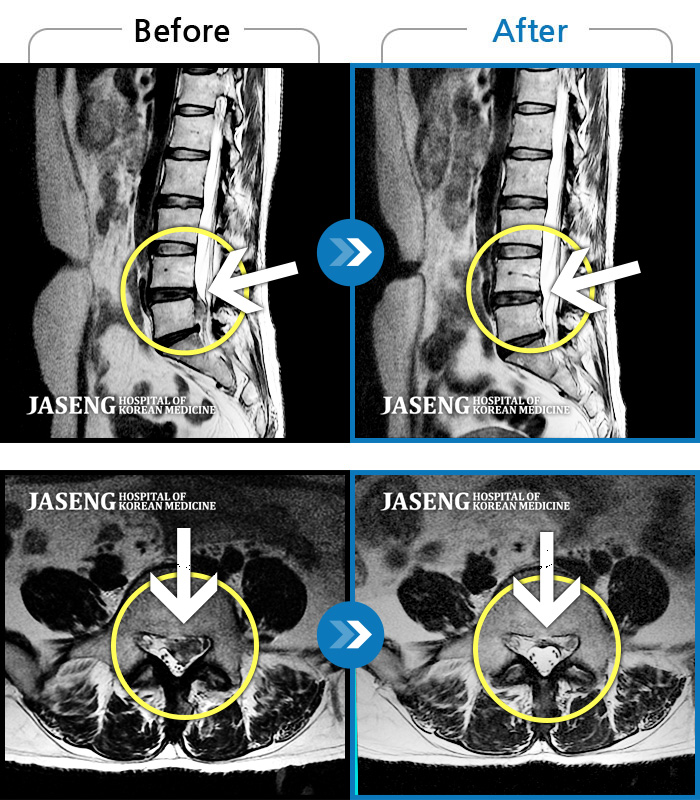 ڻѹ溴 ġ MRI  ġ-㸮  ̰ ϰ  ,  Ƹ  ؿ. ȱⰡ .