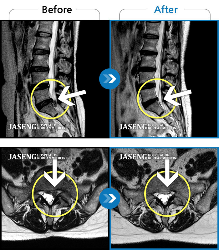 õڻѹ溴 ġ MRI  ġ-  ŵ Ұ · Ͻ ȯںԴϴ.