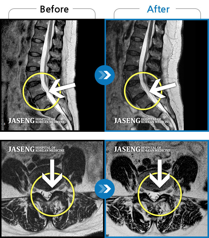 ڻѹ溴 ġ MRI  ġ-ó   㸮 ٸ   · ϼ̽ϴ.