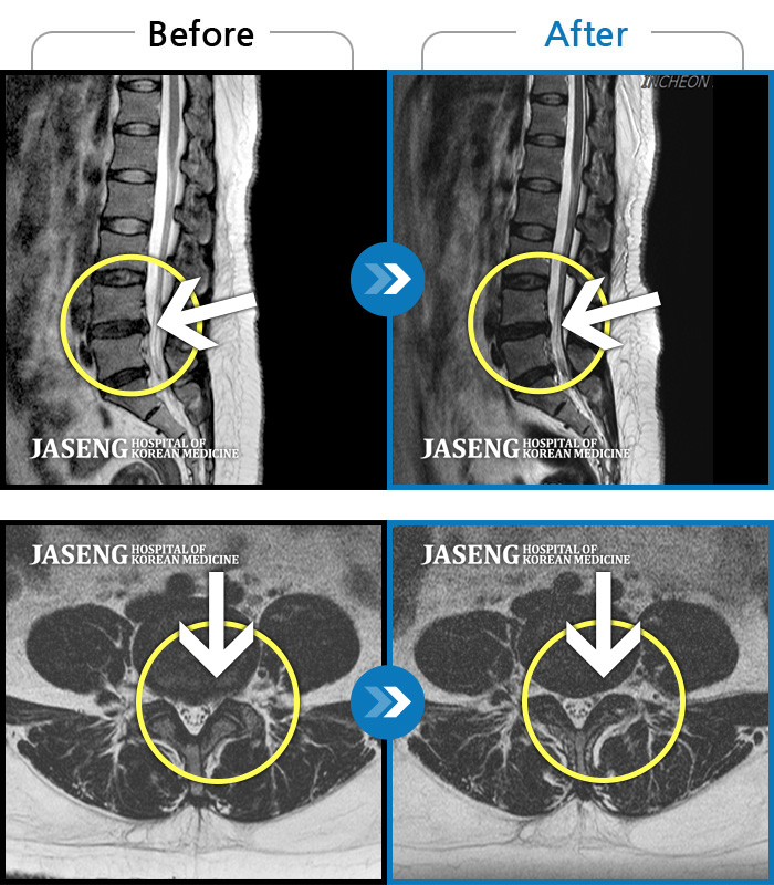 ڻѹ溴 ġ MRI  ġ-ؽ  㸮 ݵ ̱ ,     