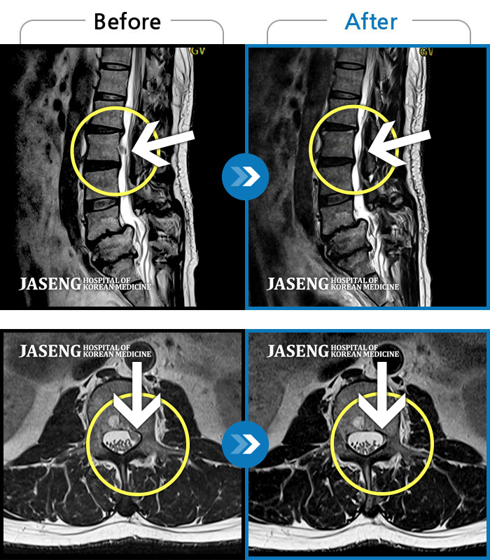 ڻѹ溴 ġ MRI  ġ- 㸮  㸮 ݵ  ֱ  ϼ̽ϴ.