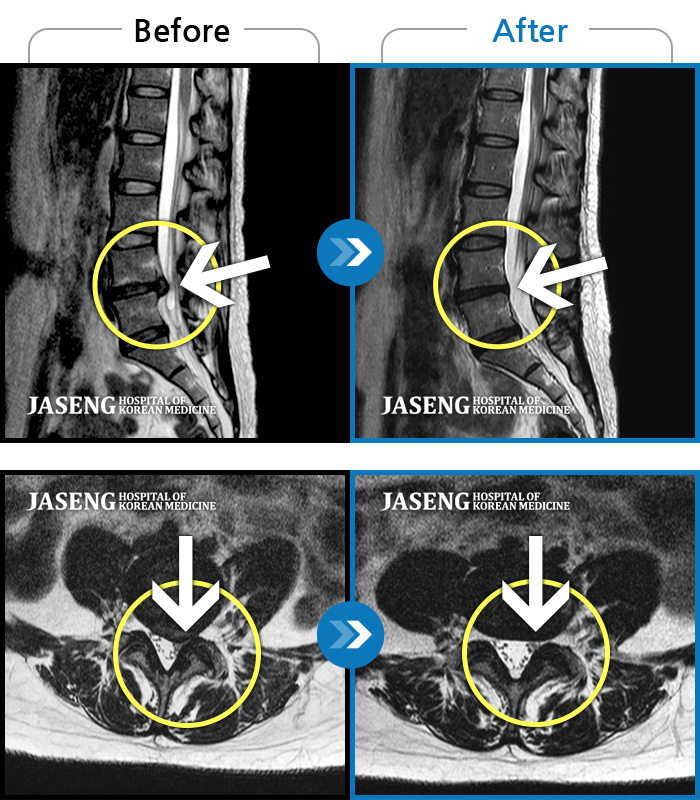 õڻѹ溴 ġ MRI  ġ-㸮, ٸ ؽ  ŵ  ϻȰ   Ұ ¿ Ͻ ȯںԴϴ.