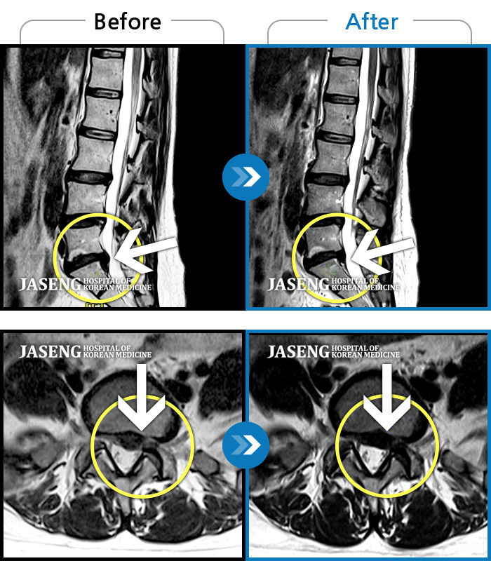 λڻѹ溴 ġ MRI  ġ- 㸮 ݰ ٸ ̾   ϼ̽ϴ.