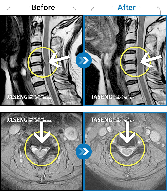 λڻѹ溴 ġ MRI  ġ-   īӰ .