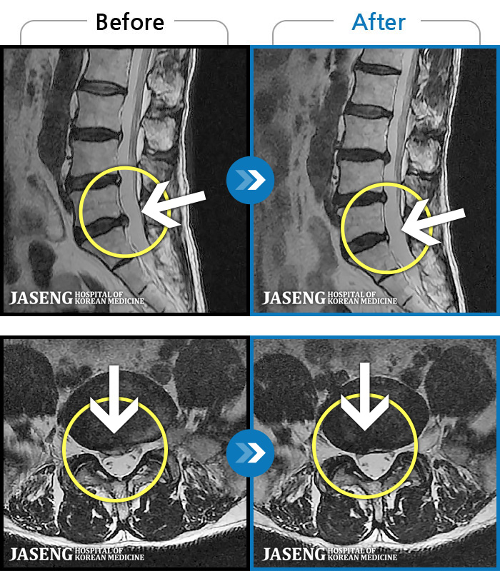 λڻѹ溴 ġ MRI  ġ-   ϰ     ӵǾϴ. ߰ Ͽ ߰   Ǵ  ߵ ̻  ȣϴ ¿ϴ.