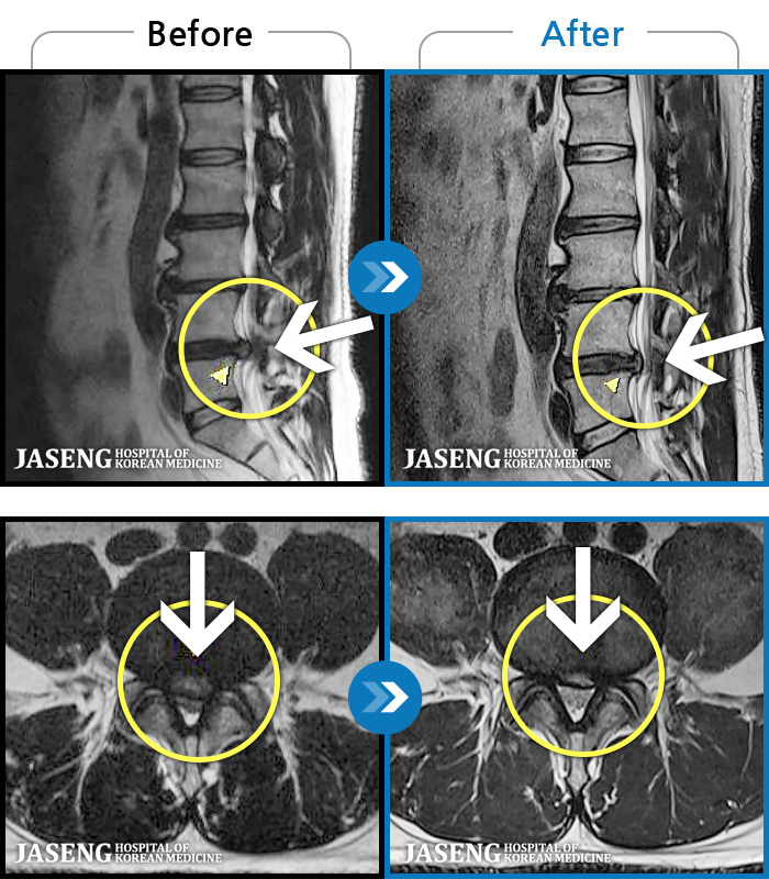 λڻѹ溴 ġ MRI  ġ-㸮  ϰ  ,   ̾   ϼ̽ϴ.