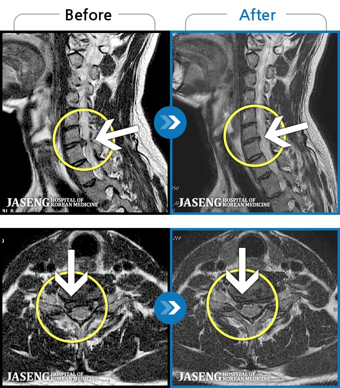 ڻѹ溴 ġ MRI  ġ- Ͽϴ.