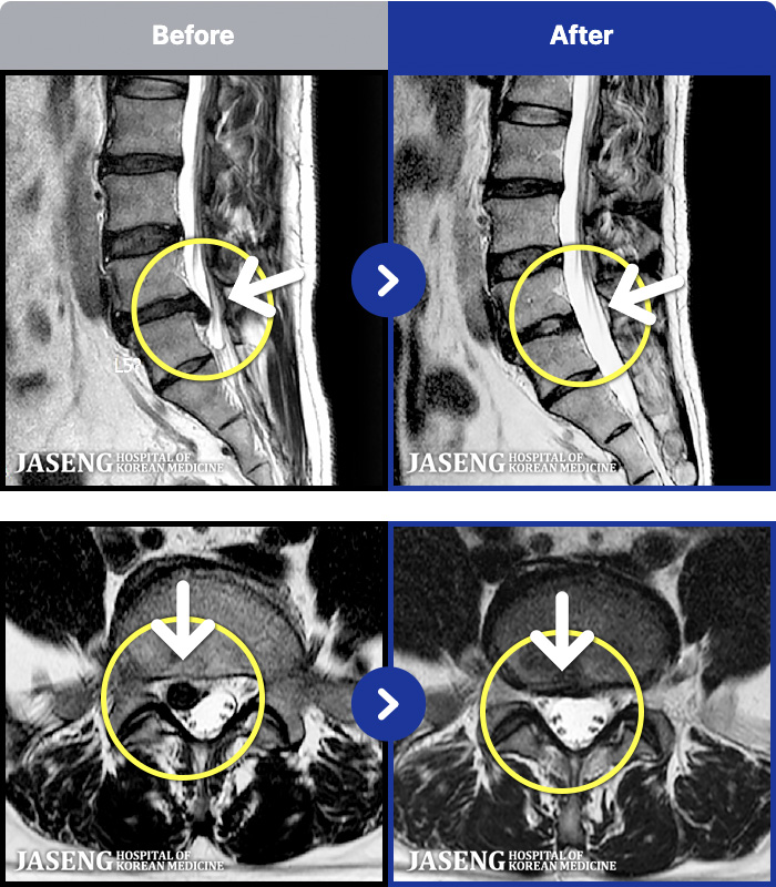 �λ��ڻ��ѹ溴�� ġ���� MRI�� ���� ġ����-�㸮 ����� ������ ������ ���Ƹ� �ٱ������� ������ ������ �̻��ϰ�, �ٸ��� ��� �����