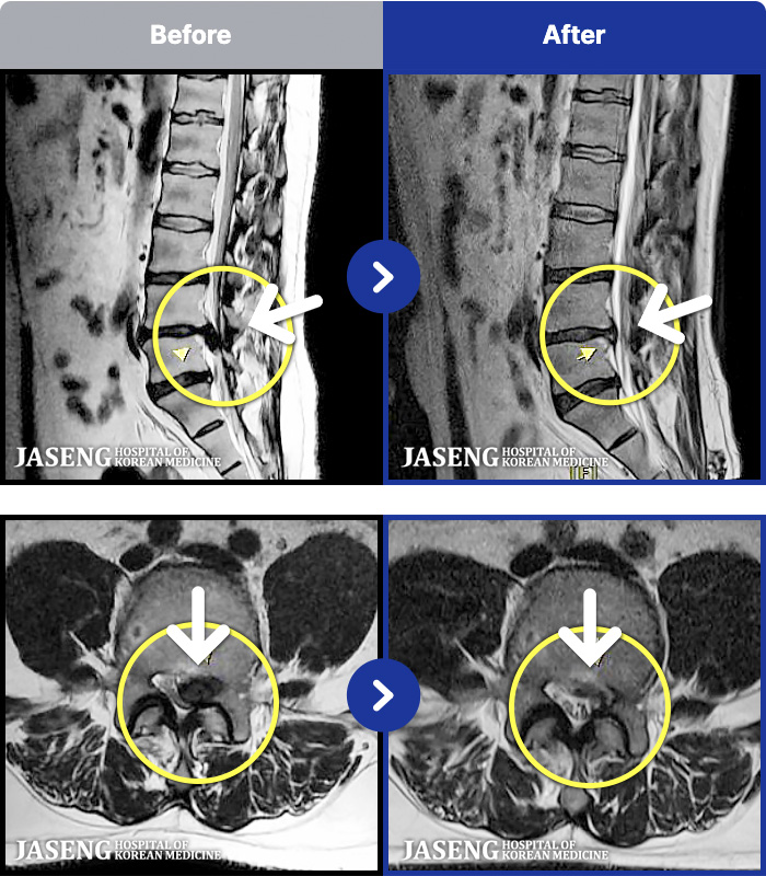 �λ��ڻ��ѹ溴�� ġ���� MRI�� ���� ġ����-�㸮 ������ ���� �кκ��� �����, �߸� ���� ������ �������� �����ϼ̽��ϴ�.