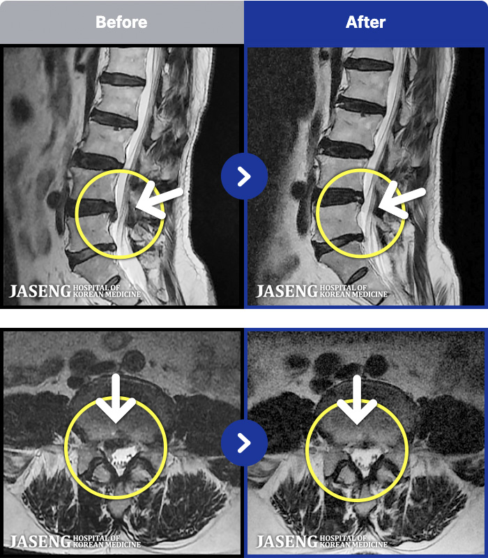 �λ��ڻ��ѹ溴�� ġ���� MRI�� ���� ġ����-�ؽ��� ���� �� ������������� ������ ����� �ϻ��Ȱ�� �Ұ����� ���·� �����ϼ̽��ϴ�.