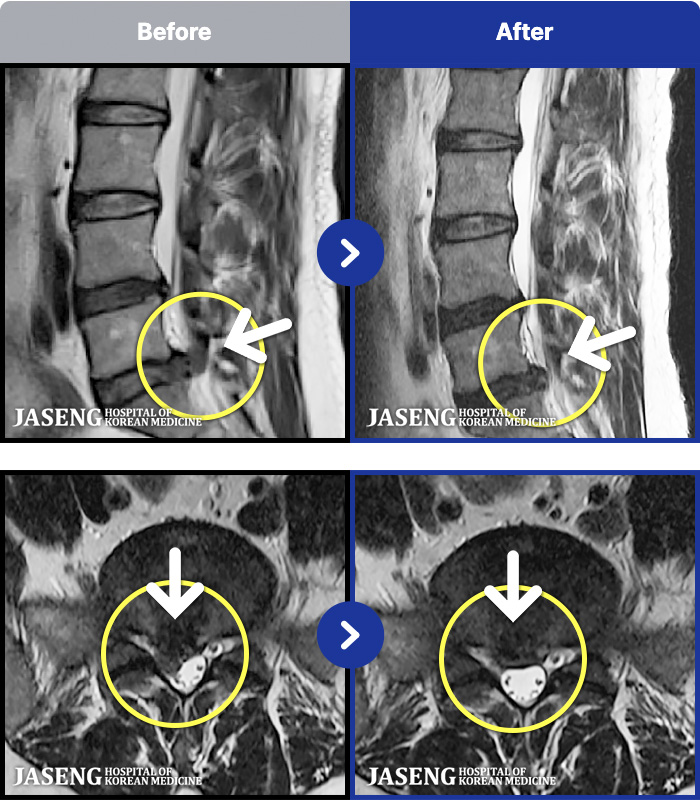 �λ��ڻ��ѹ溴�� ġ���� MRI�� ���� ġ����-���� ���� �� ���� �����ĸ�� �� ��ü�� ����, �ٷ�����