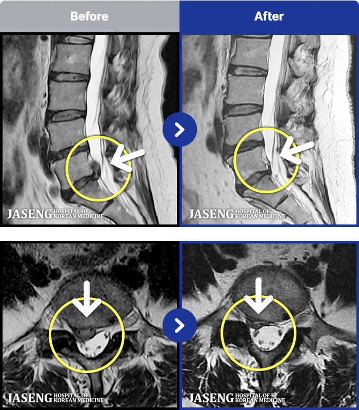 õڻѹ溴 ġ MRI ġ-㸮 ſϰ ٸ ִ.