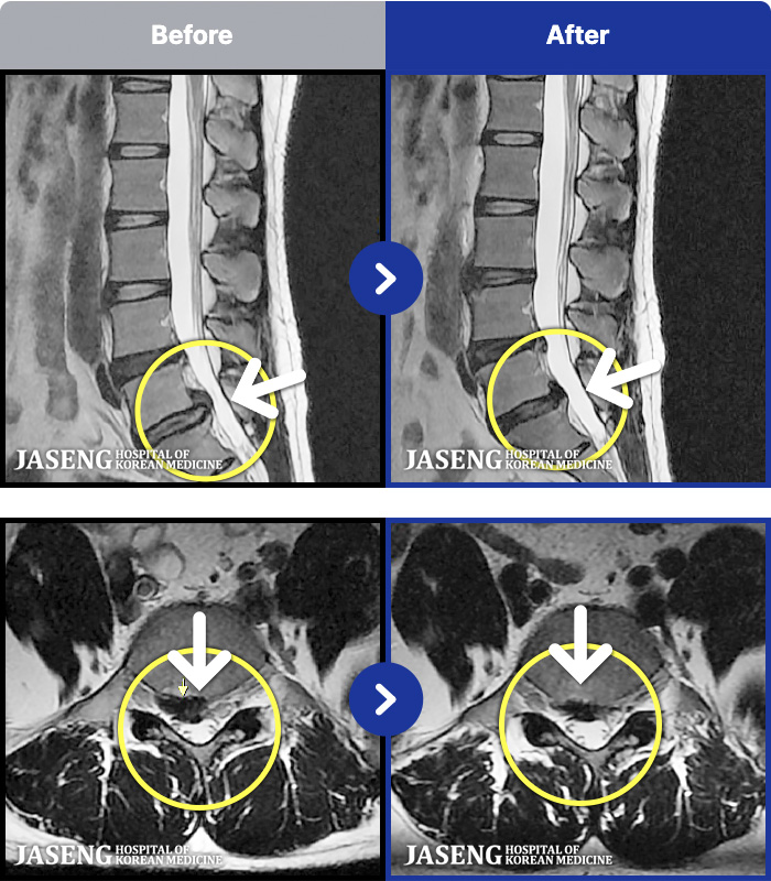 ڻѹ溴 ġ MRI ġ-㸮
