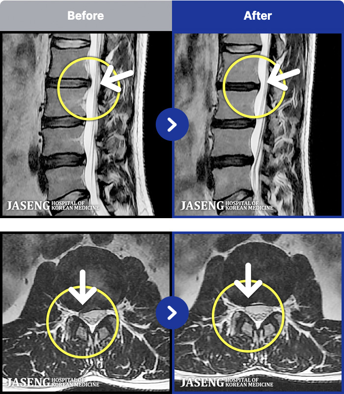 ڻѹ溴 ġ MRI ġ-㸮 ŵ ȵȴ.