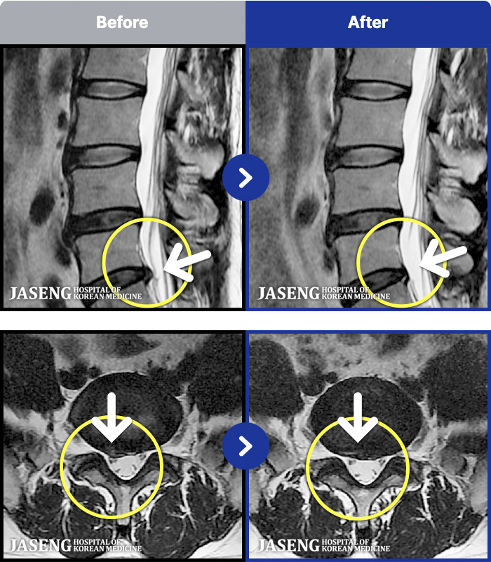 ڻѹ溴 ġ MRI ġ- ݺ