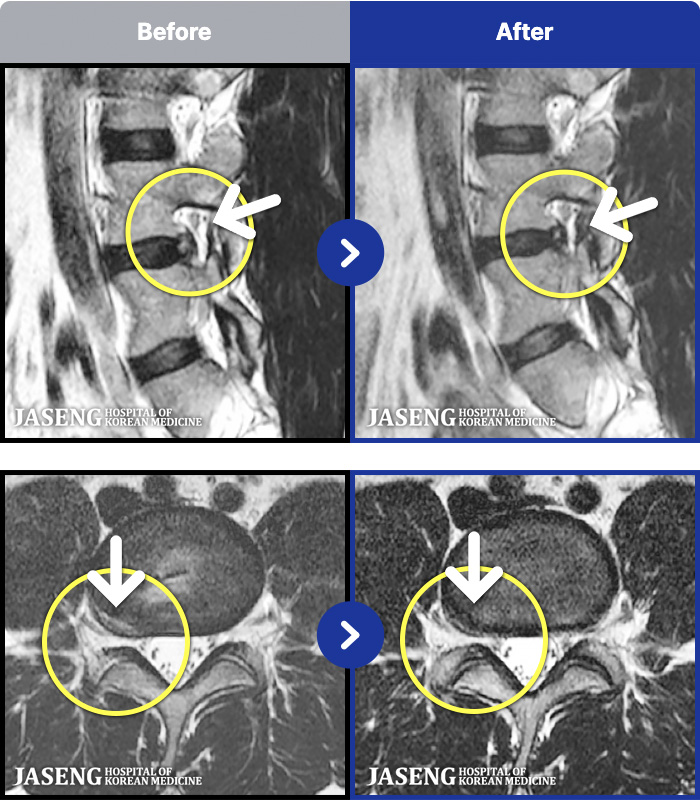 �ڻ��ѹ溴�� ġ���� MRI�� ���� ġ����-���� �ٸ� ������ �㸮 ������ ���� �ȹٷ� ���� �����, ������ �Բ� �㸮�� ������ �־����� ������ �߻��ߴ�.