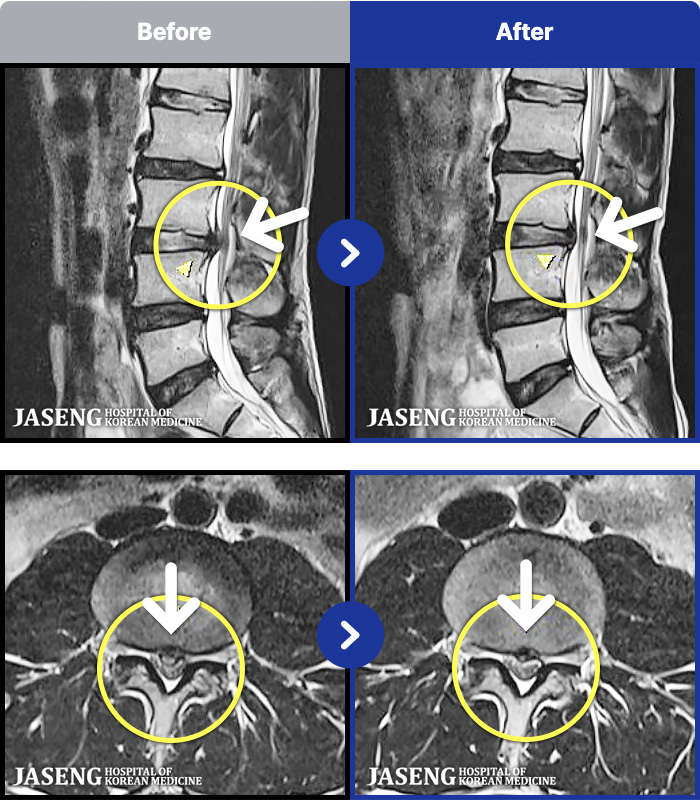 �λ��ڻ��ѹ溴�� ġ���� MRI�� ���� ġ����-�㸮���� ��� ����,  ���� �� ���� �ٸ� ������ ���� ��ȭ�Ǿ� �����ϼ̽��ϴ�.