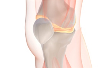 부산자생한방병원 무릎질환 무릎점액낭염-무릎점액낭염 관련 사진 입니다.