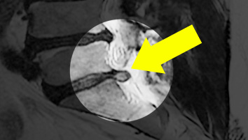 MRI  5