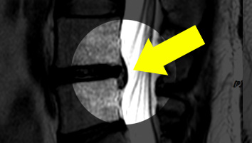 MRI  4