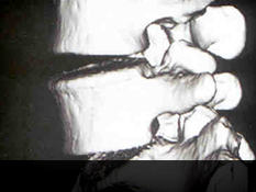 부산자생한방병원 허리질환 퇴행성디스크-정상척추에 관련된 이미지 입니다.