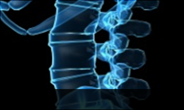 부산자생한방병원 허리질환 척추전방전위증-정상적인 사람의 척추뼈 모습입니다.
